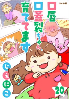 口唇口蓋裂ちゃん、育ててます(分冊版) 20巻