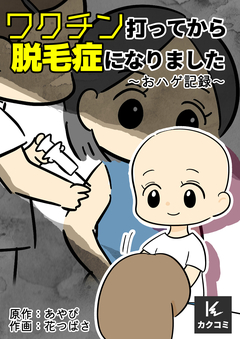 ワクチン打ってから脱毛症になりました~おハゲ記録~ 3巻