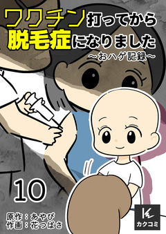 ワクチン打ってから脱毛症になりました~おハゲ記録~ 10巻